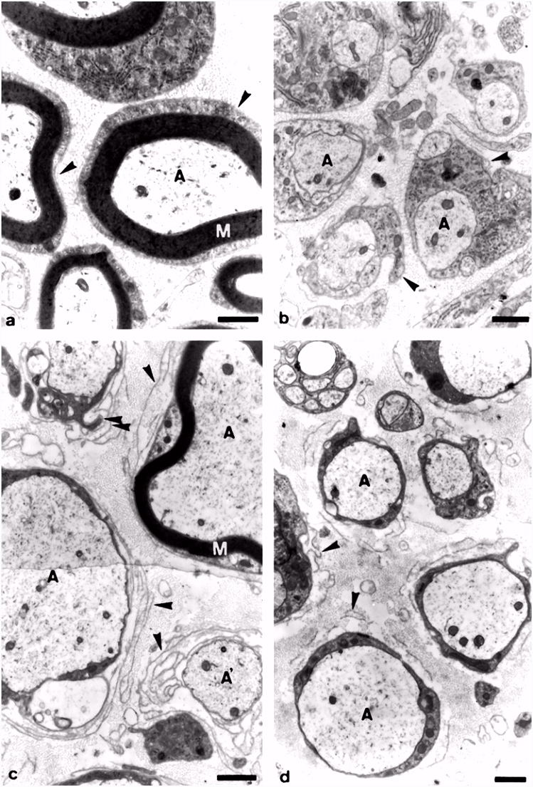 Impaired Differentiation of Schwann Cells in Transgenic Mice with
