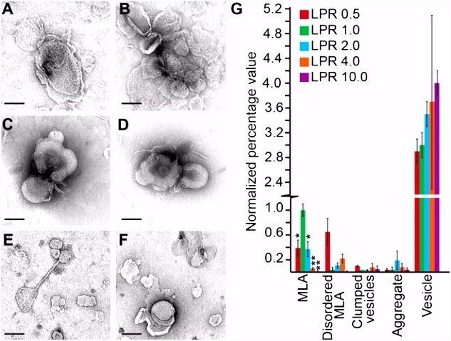 Peripheral myelin protein 22 alters membrane architecture