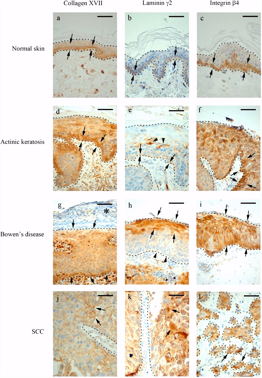 Kleurplaten Rabbids Invasion Significant Role Of Collagen Xvii and Integrin Î²4 In Migration and S6qy19bfe6 Bvcn56nok2