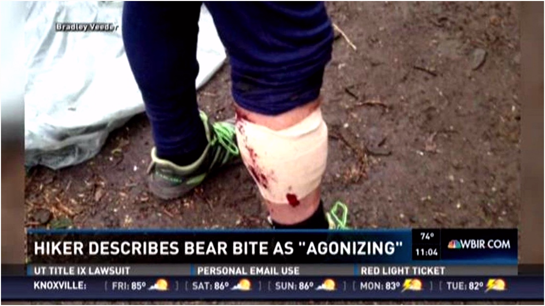 Appalachian Trail hiker describes agonizing bear