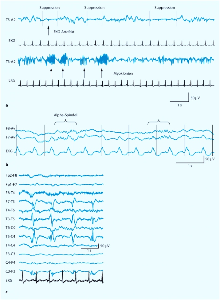 Neurophysiologische Diagnostik